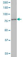 Anti-KCNC3 Mouse Monoclonal Antibody [clone: 1C1]