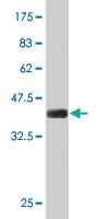 Anti-SIX4 Mouse Monoclonal Antibody [clone: 7E2]