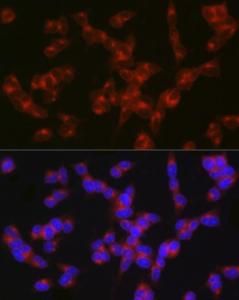 Immunofluorescence analysis of SH-SY5Y cells using Anti-5 hT2A Receptor Antibody (A307137) at a dilution of 1:200 (40X lens). DAPI was used to stain the cell nuclei (blue)