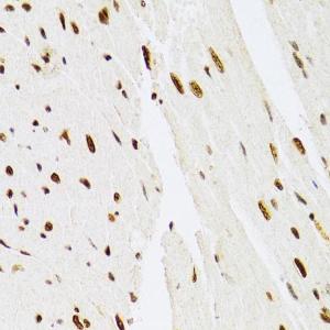 Immunohistochemistry analysis of paraffin-embedded mouse heart using Anti-ERK1 Antibody (A12556) at a dilution of 1:100 (40x lens). Perform microwave antigen retrieval with 10 mM PBS buffer pH 7.2 before commencing with IHC staining protocol.