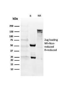 SDS-PAGE analysis of Anti-CD27 Antibody [LPFS2/4176] under non-reduced and reduced conditions; showing intact IgG and intact heavy and light chains, respectively. SDS-PAGE analysis confirms the integrity and purity of the antibody