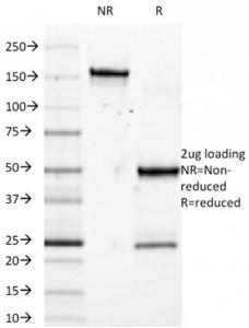 SDS-PAGE analysis of Anti-SOX10 Antibody [SOX10/992] under non-reduced and reduced conditions; showing intact IgG and intact heavy and light chains, respectively. SDS-PAGE analysis confirms the integrity and purity of the antibody