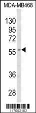 Anti-CYP4B1 Rabbit Polyclonal Antibody