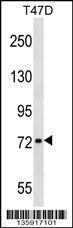 Anti-CHADL Rabbit Polyclonal Antibody (AP (Alkaline Phosphatase))