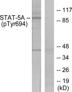 Western blot analysis of lysates from HeLa cells treated with EGF using Anti-STAT5A (phospho Tyr694) Antibody. The right hand lane represents a negative control, where the antibody is blocked by the immunising peptide