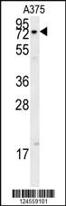 Anti-XRCC1 Rabbit Polyclonal Antibody