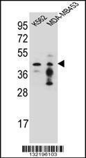 Anti-PCYT1A Rabbit Polyclonal Antibody (PE (Phycoerythrin))