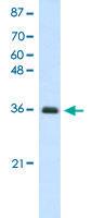 Anti-FBL Rabbit Polyclonal Antibody