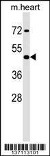 Anti-HOXA2 Rabbit Polyclonal Antibody (PE (Phycoerythrin))