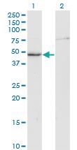 Anti-CKM Mouse Monoclonal Antibody [clone: 3E1-F3]