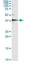 Anti-CKM Mouse Monoclonal Antibody [clone: 3E1-F3]