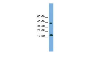 Anti-LOC152586 Rabbit Polyclonal Antibody