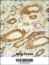 Anti-DDO Rabbit Polyclonal Antibody (AP (Alkaline Phosphatase))