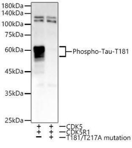 Western blot analysis of various lysates, using Anti-Tau (phospho Thr181) Antibody [ARC54951] (A308181) at 1:20000 dilution