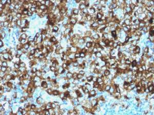 Anti-Melanoma gp100 antibody