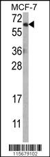 Anti-GAGE12H Rabbit Polyclonal Antibody