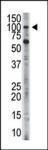 Anti-Hexokinase 3 Rabbit Polyclonal Antibody (AP (Alkaline Phosphatase))