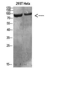 Antibody anti-IL4R 100 µg