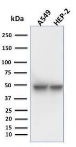 Western blot analysis of human A549 and HEP-2 cell lysates using Anti-Cytokeratin 18 Antibody [KRT18/1190]