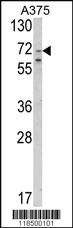 Anti-SLC23A2 Rabbit Polyclonal Antibody