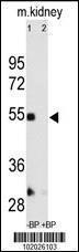 Anti-MMP12 Rabbit Polyclonal Antibody (Biotin)