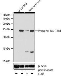 Western blot analysis of extracts of various cell lines, using Anti-Tau (phospho Thr181) Antibody (A308182) at 1:10,000 dilution. Lysates/proteins were present at 25 µg per lane. The blocking buffer used was 3% non-fat dry milk in TBST. Detection was with a ECL Basic Kit