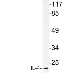 Western blot analysis of lysate from MCF 7cells using Anti-IL-4 Antibody