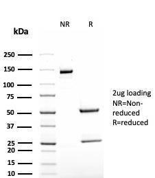 SDS-PAGE analysis of Anti-TAG72 Antibody [rB72.3] under non-reduced and reduced conditions; showing intact IgG and intact heavy and light chains, respectively. SDS-PAGE analysis confirms the integrity and purity of the antibody.