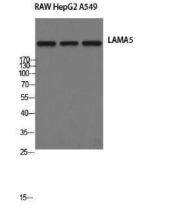 Western blot analysis of RAW HepG2 A549 cells using Anti-LAMA5 Antibody