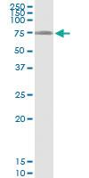 Anti-LARP6 Polyclonal Antibody Pair