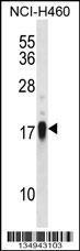 Anti-CD70 Rabbit Polyclonal Antibody (Biotin)