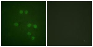 Immunofluorescence analysis of HepG2 cells using Anti-HMG14 Antibody. The right hand panel represents a negative control, where the antibody was pre-incubated with the immunising peptide.