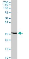 Anti-RGS20 Rabbit Polyclonal Antibody