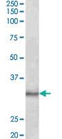 Anti-CTDSP1 Goat Polyclonal Antibody