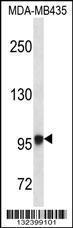 Anti-EXTL3 Rabbit Polyclonal Antibody (FITC (Fluorescein Isothiocyanate))