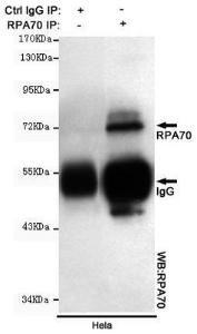 Anti-RPA1 Mouse Monoclonal Antibody [clone: 13k116]