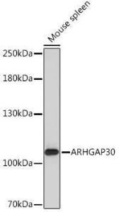 Western blot analysis of extracts of Mouse spleen, using Anti-ARHGAP30 Antibody (A308183) at 1:1,000 dilution