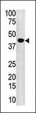 Anti-MID2 Rabbit Polyclonal Antibody