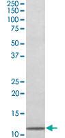 Anti-B2M Goat Polyclonal Antibody