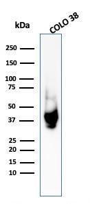 Anti-Melanoma gp100 antibody