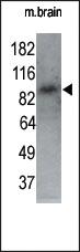 Anti-MARK1 Rabbit Polyclonal Antibody