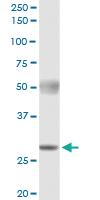 Anti-PYCRL Polyclonal Antibody Pair