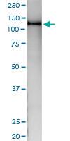 Anti-NEK9 Polyclonal Antibody Pair