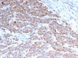 Anti-Cytokeratin 18 antibody