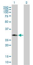 Anti-PHYHD1 Mouse Polyclonal Antibody