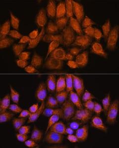 Immunofluorescence analysis of HeLa cells using Anti-ARHGAP30 Antibody (A308183) at a dilution of 1:100. DAPI was used to stain the cell nuclei (blue)