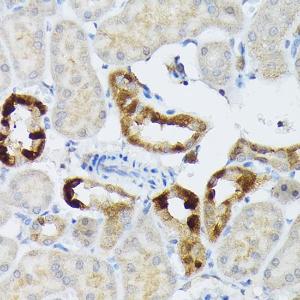 Immunohistochemistry analysis of paraffin-embedded mouse kidney using Anti-BMP2 Antibody (A12559) at a dilution of 1:50 (40X lens). Perform high pressure antigen retrieval with 10 mM citrate buffer pH 6.0 before commencing with IHC staining protocol