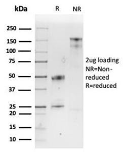 Antibody anti-SPARC OSTN3932 100 µg