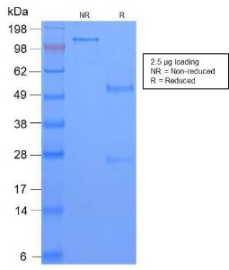 SDS-PAGE analysis of Anti-TAG72 Antibody [CA72/2869R] under non-reduced and reduced conditions; showing intact IgG and intact heavy and light chains, respectively. SDS-PAGE analysis confirms the integrity and purity of the antibody