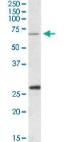 Anti-CPT2 Goat Polyclonal Antibody